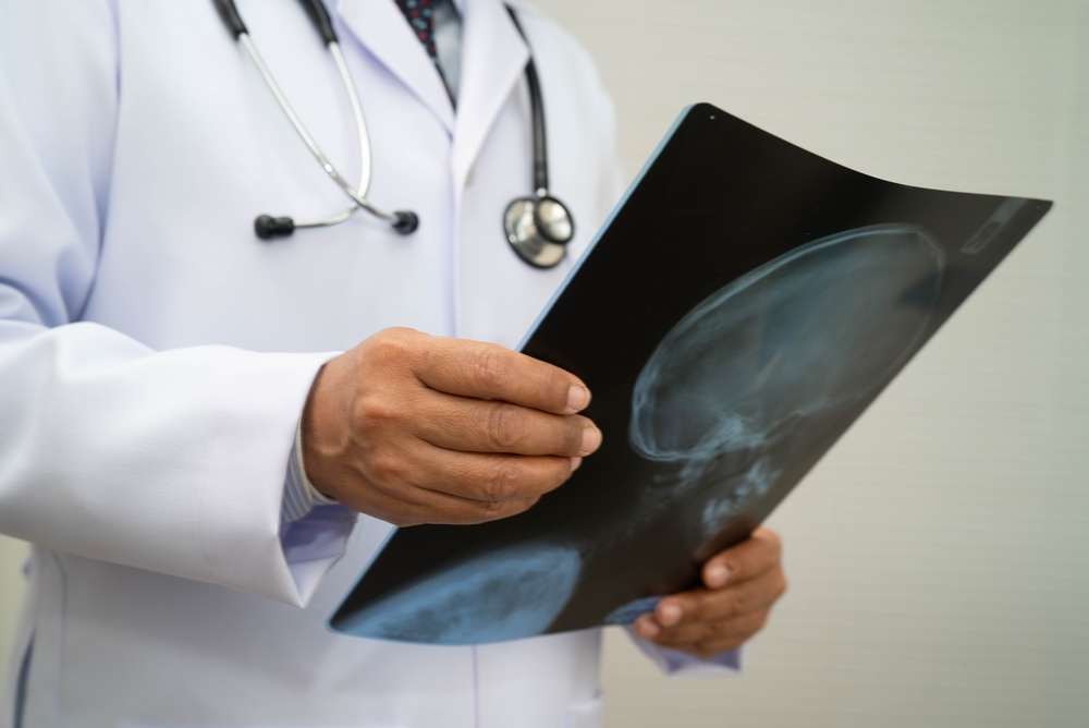 Close-up of doctor's hands holding a scan of a skull and spine